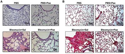 Prevention of Bleomycin-Induced Pulmonary Inflammation and Fibrosis in Mice by Paeonol